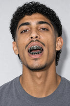 Black grillz — porté sur fond gris